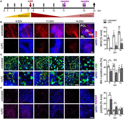 Polysialic acid promotes remyelination in cerebellar slice cultures by Siglec-E-dependent modulation of microglia polarization